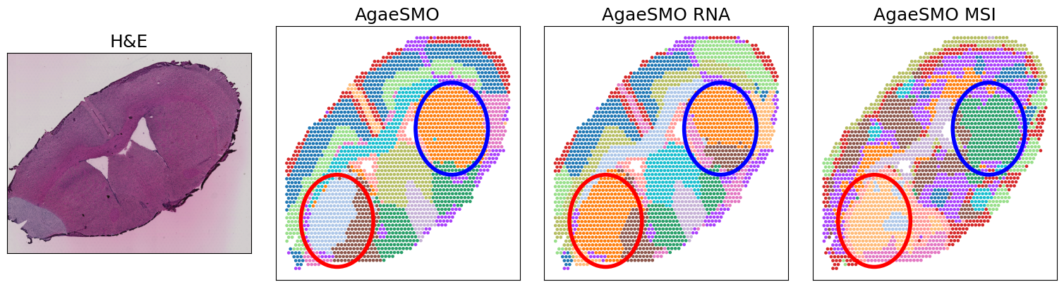 _images/Tutorials_ST_SM_downstream_5_1.png